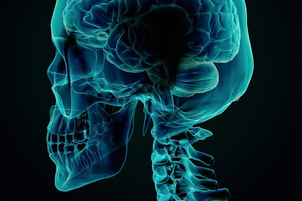 Cranial Nerve Blocks