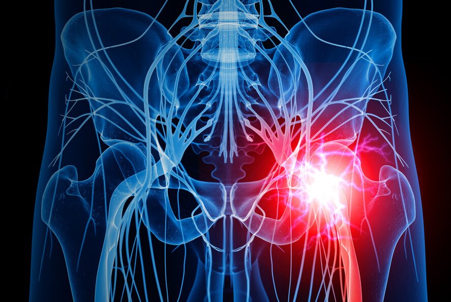 Peripheral Nerve Blocks